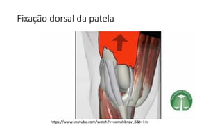 Fixação dorsal da patela
https://www.youtube.com/watch?v=xxmahbnzv_8&t=14s
 