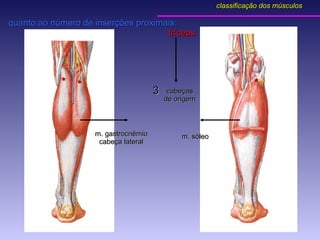 quanto ao número de inserções proximais:  tríceps * * * m. gastrocnêmio cabeça lateral m. sóleo cabeças de origem 3 classificação dos músculos 
