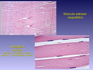 Músculo estriado  esquelético estriações visíveis bandas I – isotrópicas- claras bandas A – anisotrópicas -escuras 