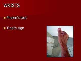 WRISTS


Phalen’s test



Tinel’s sign

 