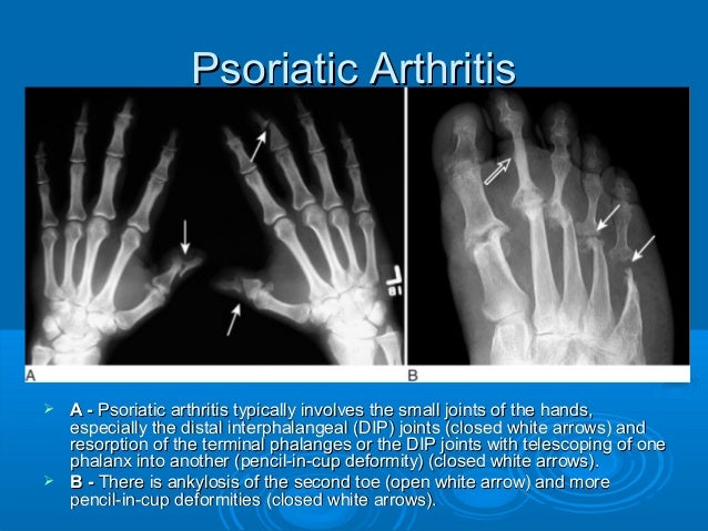 Musculoskeletal Radiology