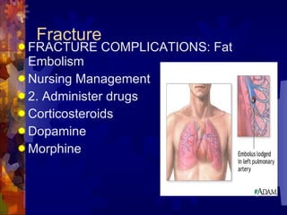 Fracture FRACTURE COMPLICATIONS: Fat Embolism Nursing Management 2. Administer drugs Corticosteroids Dopamine Morphine 
