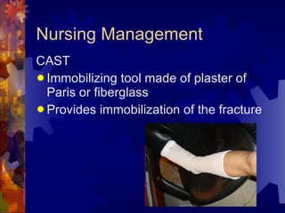 Nursing Management CAST Immobilizing tool made of plaster of Paris or fiberglass Provides immobilization of the fracture 