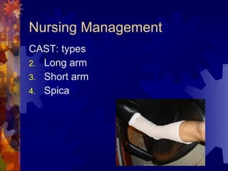 Nursing Management CAST: types Long arm Short arm Spica  