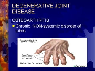 DEGENERATIVE JOINT DISEASE OSTEOARTHRITIS Chronic, NON-systemic disorder of joints 