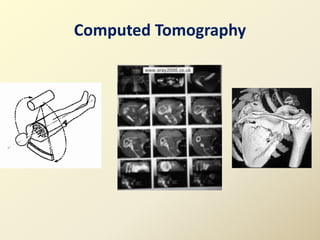 Computed Tomography
 