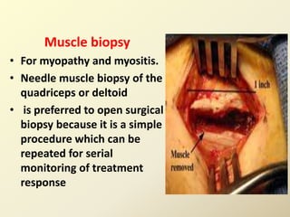 Muscle biopsy
• For myopathy and myositis.
• Needle muscle biopsy of the
quadriceps or deltoid
• is preferred to open surgical
biopsy because it is a simple
procedure which can be
repeated for serial
monitoring of treatment
response
 
