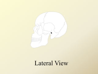Lateral View
 