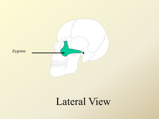 Zygoma
Lateral View
 