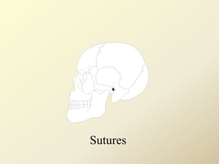 Sutures
 