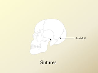 Lambdoid
Sutures
 