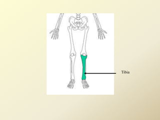 Tibia
 