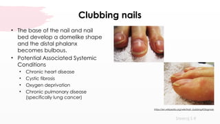 Nail Clubbing Algorithm musculoskeletalassessment-210420083955.pptx