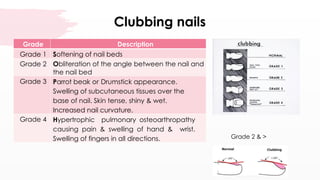 Nail Clubbing Algorithm musculoskeletalassessment-210420083955.pptx