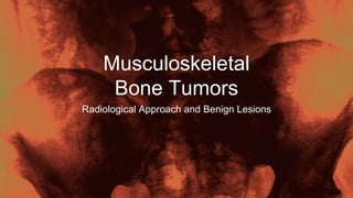 Musculoskeletal
Bone Tumors
Radiological Approach and Benign Lesions
 