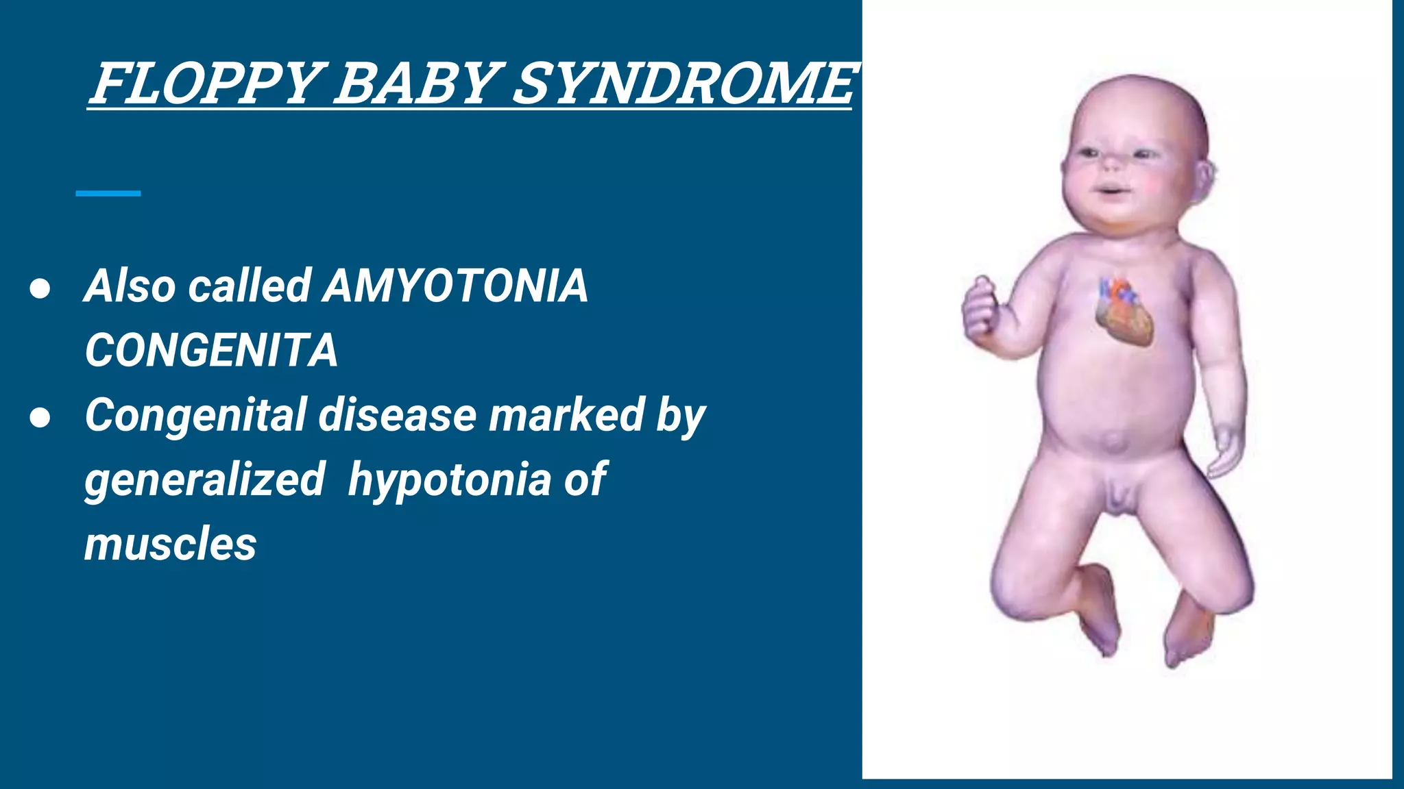 _Musculoskeletal Disorders - CHN.pptx
