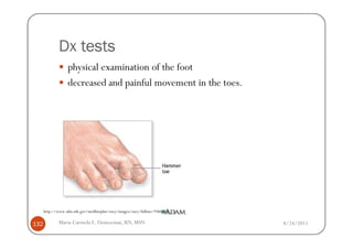 Dx tests
                   physical examination of the foot
                   decreased and painful movement in the toes.




      http://www.nlm.nih.gov/medlineplus/ency/images/ency/fullsize/9360.jpg

132           Maria Carmela L. Domocmat, RN, MSN                              8/24/2011
 
