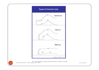 http://www.myfootshop.com/images/medical/ortho/hammer_toe_differences_mod.jpg
134   Maria Carmela L. Domocmat, RN, MSN                                                                   8/24/2011
 