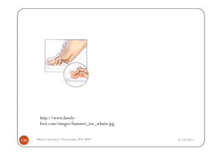 http://www.family-
       foot.com/images/hammer_toe_whatis.jpg


136   Maria Carmela L. Domocmat, RN, MSN       8/24/2011
 