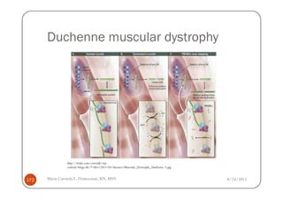Duchenne muscular dystrophy




               http://trialx.com/curetalk/wp-
               content/blogs.dir/7/files/2011/05/diseases/Muscular_Dystrophy_Duchenne-3.jpg


172   Maria Carmela L. Domocmat, RN, MSN                                                      8/24/2011
 