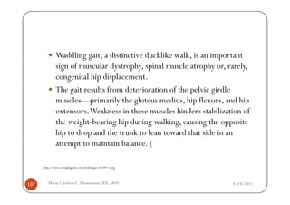 Waddling gait, a distinctive ducklike walk, is an important
              sign of muscular dystrophy, spinal muscle atrophy or, rarely,
              congenital hip displacement.
              The gait results from deterioration of the pelvic girdle
              muscles—primarily the gluteus medius, hip flexors, and hip
              extensors. Weakness in these muscles hinders stabilization of
              the weight-bearing hip during walking, causing the opposite
              hip to drop and the trunk to lean toward that side in an
              attempt to maintain balance. (

      http://www.wrongdiagnosis.com/bookimages/8/2591.1.png




197      Maria Carmela L. Domocmat, RN, MSN                          8/24/2011
 