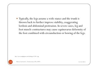 Typically, the legs assume a wide stance and the trunk is
              thrown back to further improve stability, exaggerating
              lordosis and abdominal protrusion. In severe cases, leg and
              foot muscle contractures may cause equinovarus deformity of
              the foot combined with circumduction or bowing of the legs.




      http://www.wrongdiagnosis.com/bookimages/8/2591.1.png




198      Maria Carmela L. Domocmat, RN, MSN                       8/24/2011
 