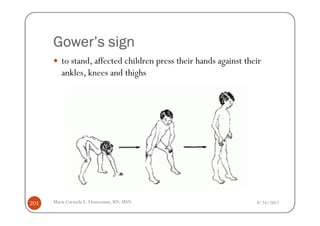 Gower’s sign
         to stand, affected children press their hands against their
         ankles, knees and thighs




201   Maria Carmela L. Domocmat, RN, MSN                          8/24/2011
 