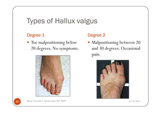 Types of Hallux valgus
     Degree 1                             Degree 2
        Toe malpositioning below           Malpositioning between 20
        20 degrees. No symptoms.           and 30 degrees. Occasional
                                           pain.




80   Maria Carmela L. Domocmat, RN, MSN                        8/24/2011
 
