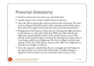 Proximal Osteotomy
                 the first metatarsal is cut at the near end of the bone
                 usually requires two or three small incisions in the foot.
                 Once the skin is opened the surgeon performs the osteotomy. The bone
                 is then realigned and held in place with metal pins until it heals. Again,
                 this reduces the angle between the first and second metatarsal bones.
                 Realignment of the big toe is then done by releasing the tight structures
                 on the lateral, or outer, side of the first MTP joint. This includes the
                 tight joint capsule and the tendon of the adductor hallucis muscle. This
                 muscle tends to pull the big toe inward. By releasing the tendon, the toe
                 is no longer pulled out of alignment. The toe is realigned and the joint
                 capsule on the side of the big toe closest to the other toe is tightened to
                 keep the toe straight, or balanced.
                 Once the surgeon is satisfied that the toe is straight and well balanced,
                 the skin incisions are closed with small stitches. A bulky bandage is
                 applied to the foot before you are returned to the recovery room.

87          Maria Carmela L. Domocmat, RN, MSN
     http://www.concordortho.com/patient-education/topic-detail-                    8/24/2011
     popup.aspx?topicID=a5cea3a8a6d8093483657c959125dbaf
 