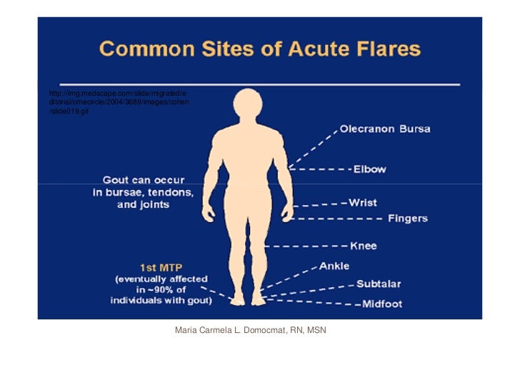 Osteoarthritis & Gouty Arthritis
