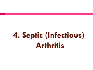 4. Septic (Infectious)
Arthritis
 