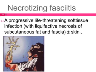 Necrotizing fasciitis
 A progressive life-threatening softtissue
infection (with liquifactive necrosis of
subcutaneous fat and fascia) ± skin .
175
 