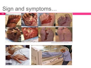Sign and symptoms…
182
 