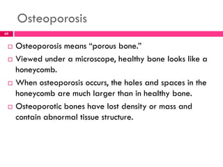 Osteoporosis
 Osteoporosis means ―porous bone.‖
 Viewed under a microscope, healthy bone looks like a
honeycomb.
 When osteoporosis occurs, the holes and spaces in the
honeycomb are much larger than in healthy bone.
 Osteoporotic bones have lost density or mass and
contain abnormal tissue structure.
69
 