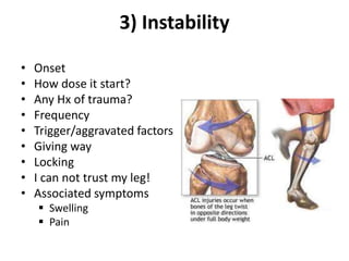3) Instability
• Onset
• How dose it start?
• Any Hx of trauma?
• Frequency
• Trigger/aggravated factors
• Giving way
• Locking
• I can not trust my leg!
• Associated symptoms
 Swelling
 Pain
 