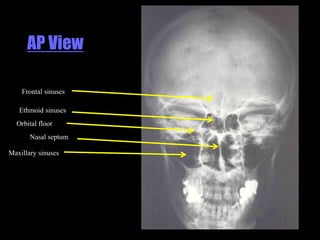 Musculoskeletal Imaging 09
