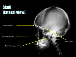 Musculoskeletal Imaging 09