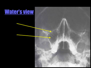 Musculoskeletal Imaging 09