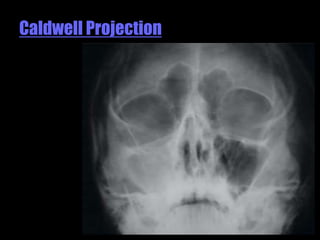 Musculoskeletal Imaging 09
