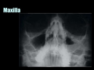 Musculoskeletal Imaging 09