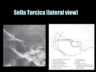 Musculoskeletal Imaging 09