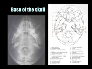 Musculoskeletal Imaging 09