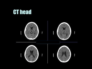 Musculoskeletal Imaging 09