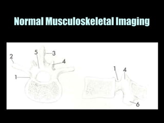 Musculoskeletal Imaging 09