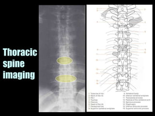 Musculoskeletal Imaging 09