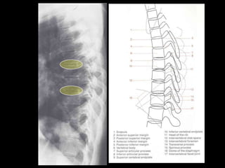 Musculoskeletal Imaging 09