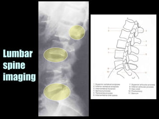 Musculoskeletal Imaging 09