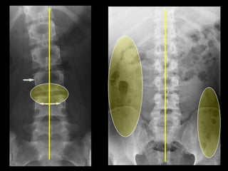 Musculoskeletal Imaging 09