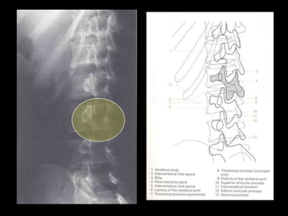 Musculoskeletal Imaging 09