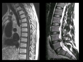 Musculoskeletal Imaging 09